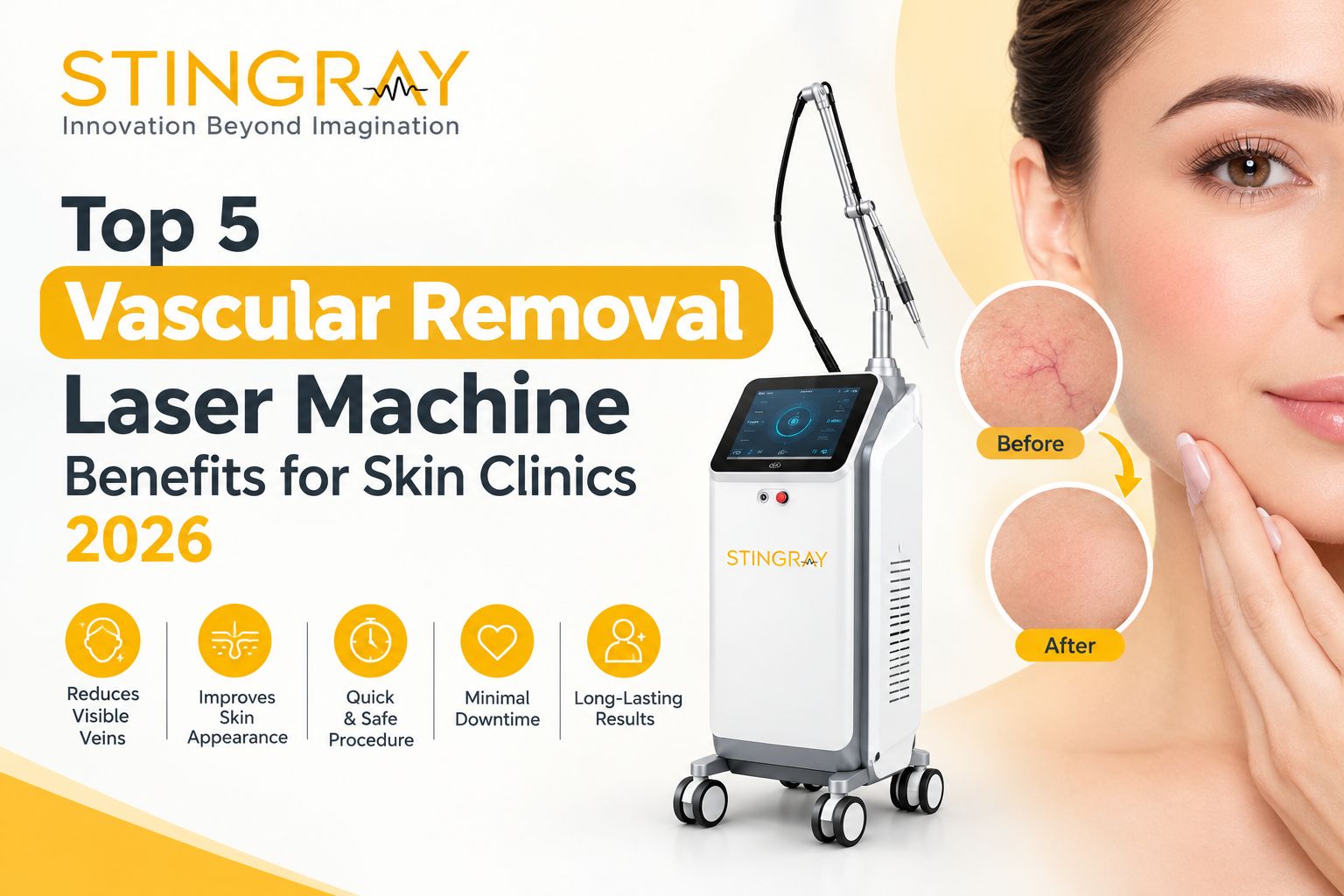 Top 5 Vascular Removal Laser Machine Benefits for Skin Clinics 2026