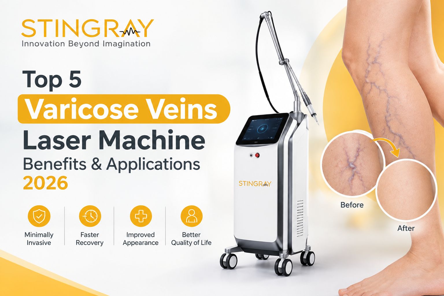 Top 5 Varicose Veins Laser Machine Benefits & Applications 2026 Top 5 Varicose Veins Laser Machine Benefits & Applications 2026