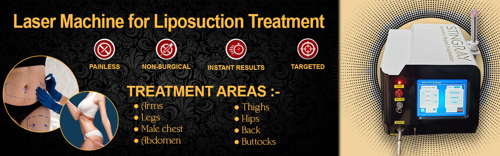 Laser Machine for liposuction Treatment in Delhi