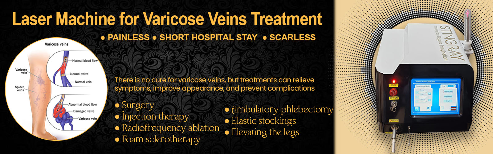 Laser Machine for Varicose Veins Treatment in Delhi